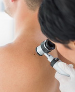 Cura del melanoma, nuove prospettive dai farmaci innovativi